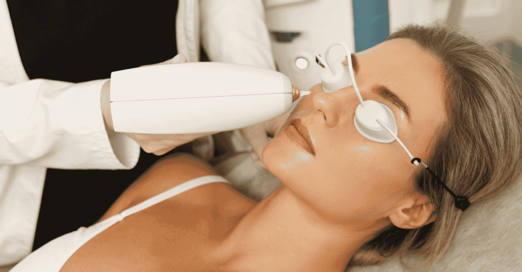 IPL Photofacial Treatment