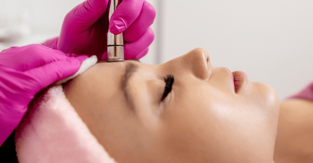 Microdermabrasion