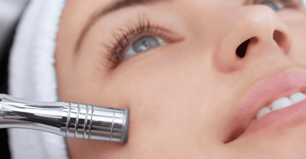 Microdermabrasion