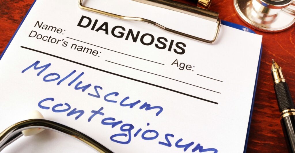 Molluscum Contagiosum