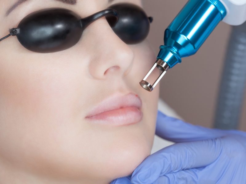 permanent make up removal