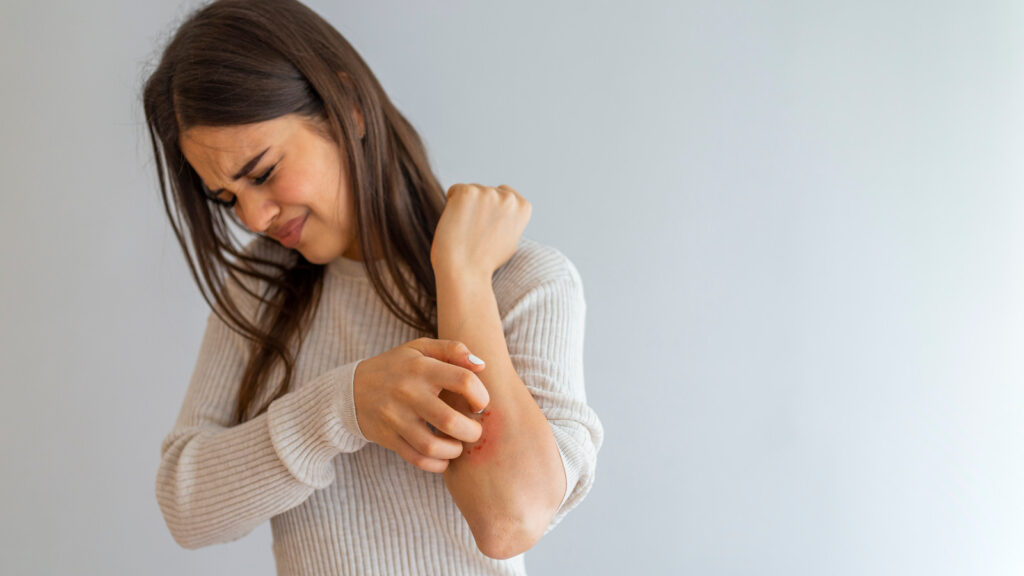 Dermatitis
