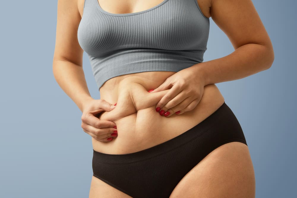 Tummy Tuck