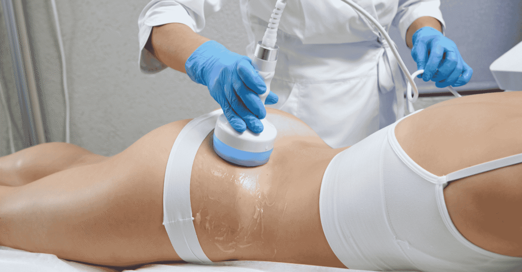 Buttock Contouring