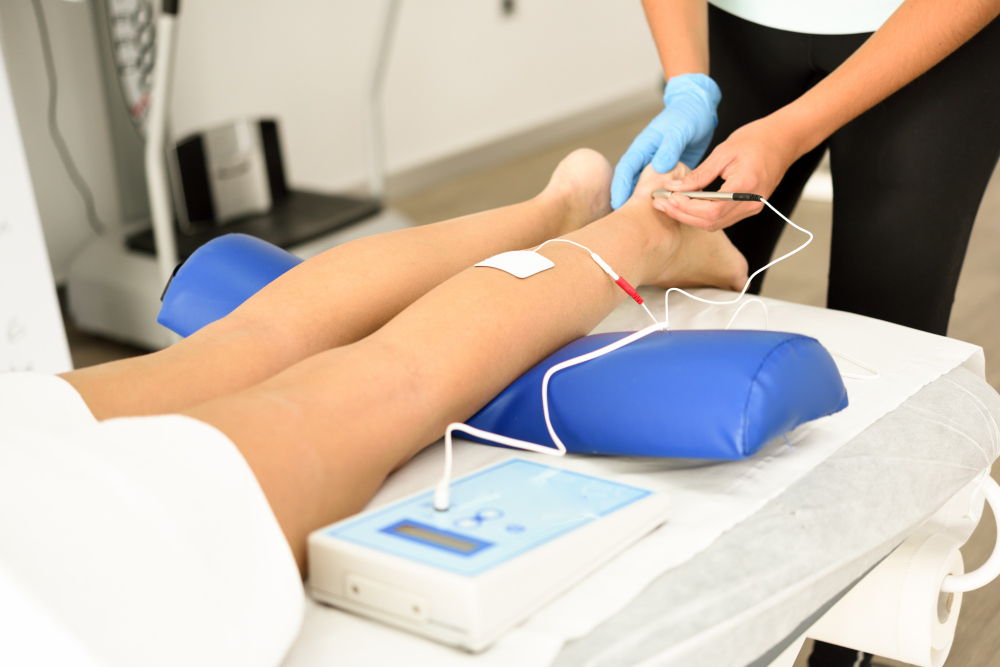 Sclerotherapy