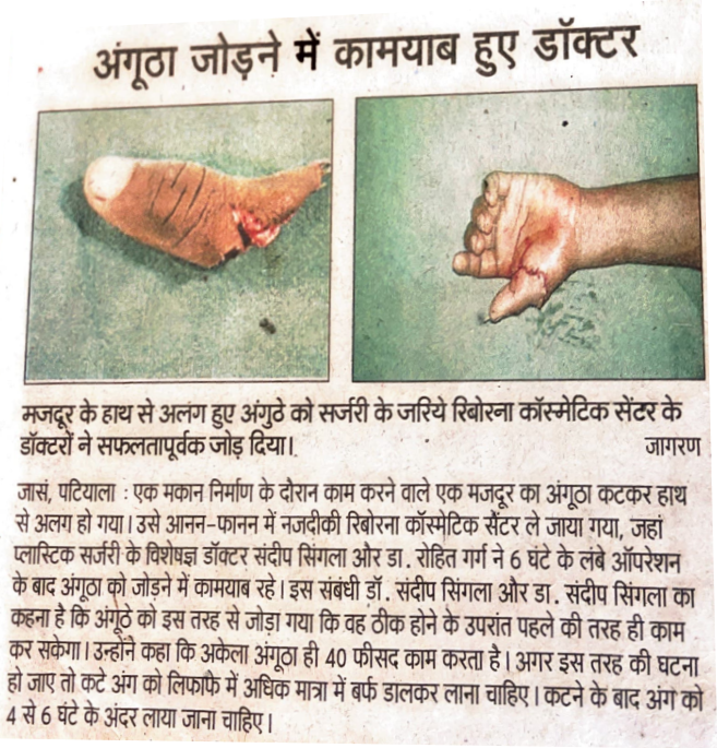 thumb surgery