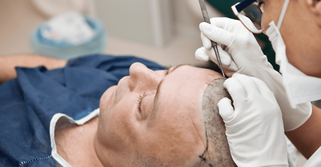 hair transplant surgery