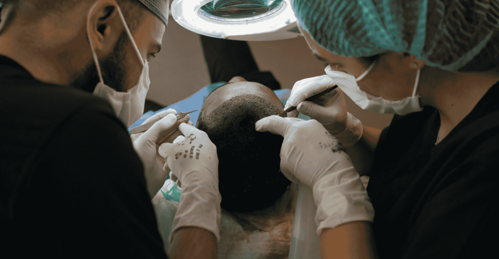 Hair transplant