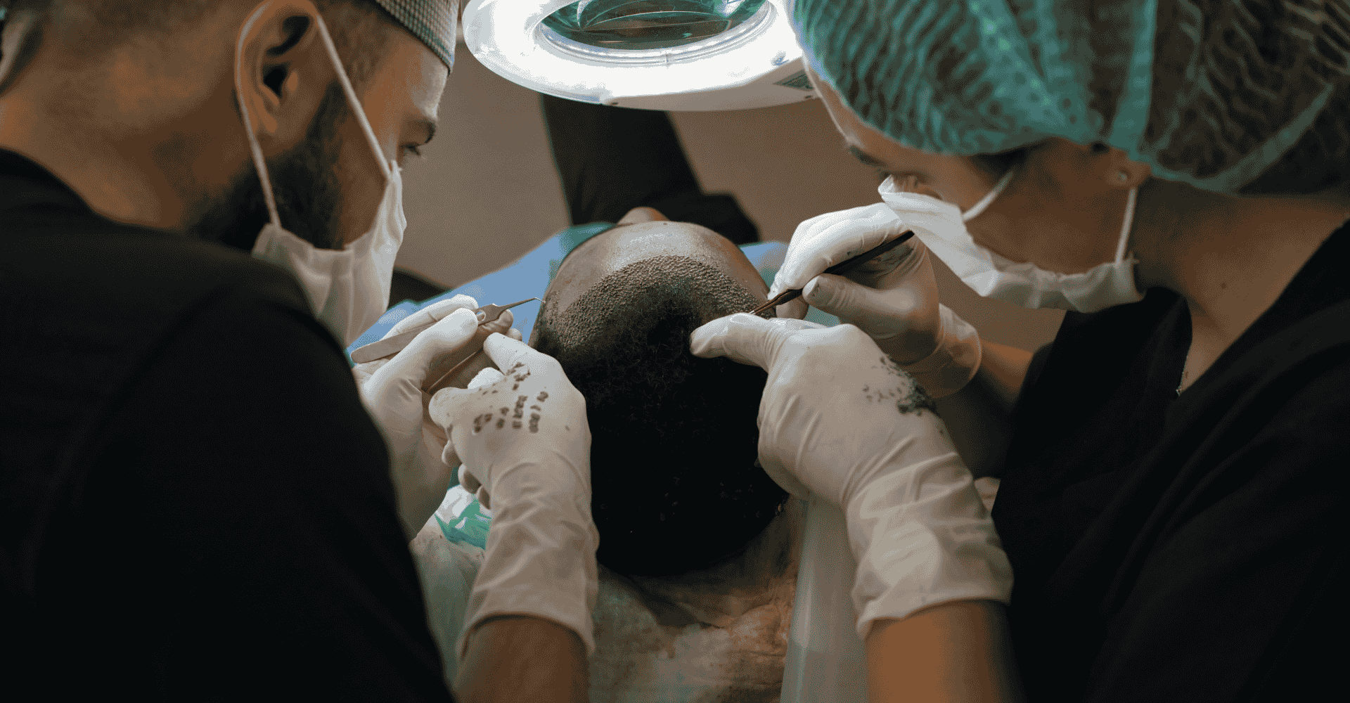 Hair transplant