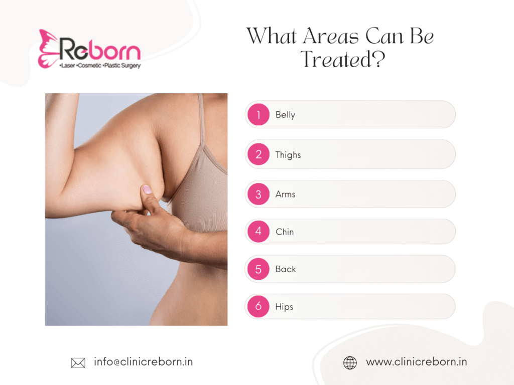 Liposuction areas