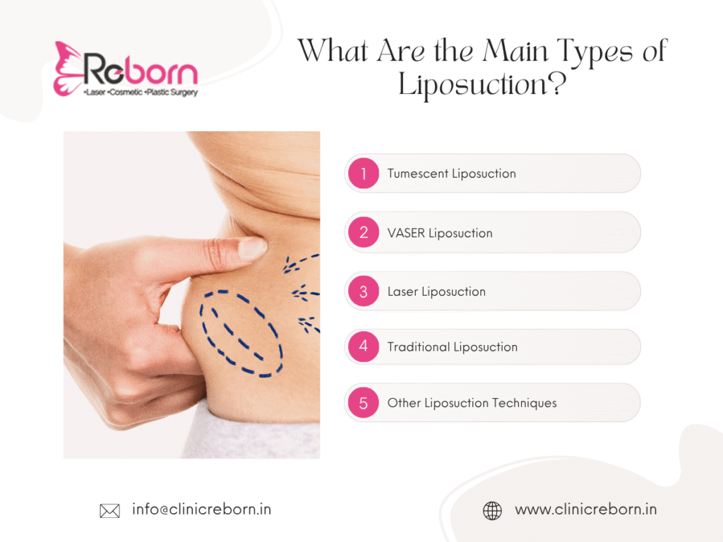 Main types of liposuction
