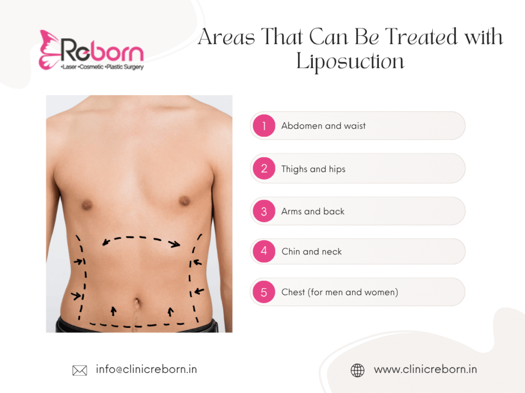 Liposuction treatment areas
