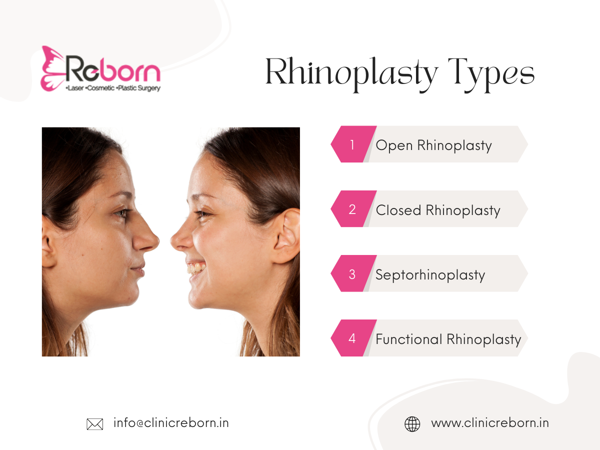 Types of Rhinoplasty