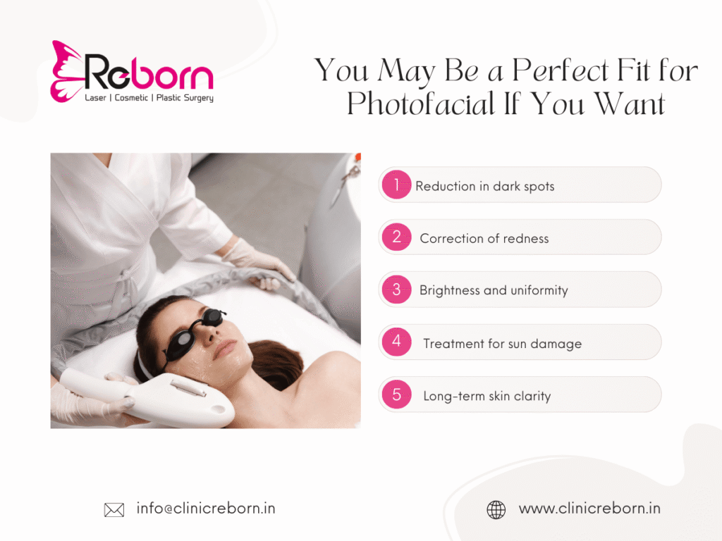 photofacial-treatment