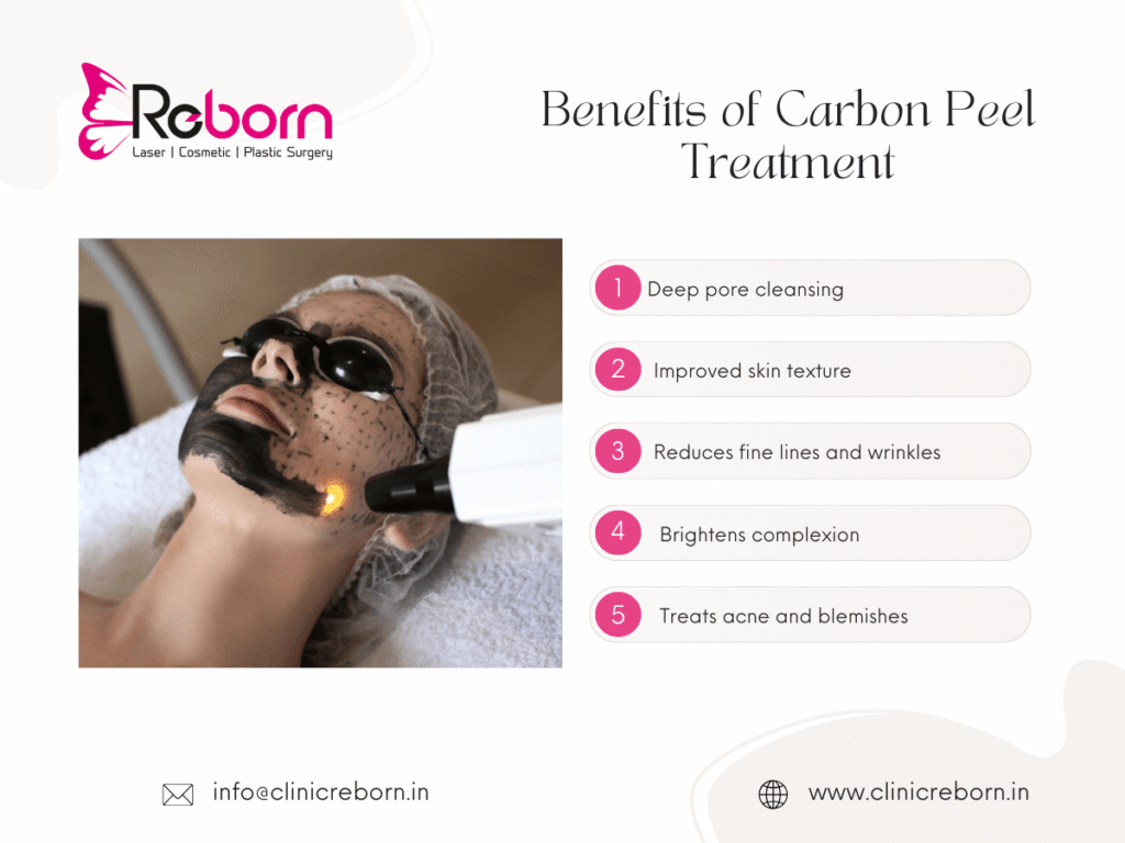 Carbon Peel Treatment