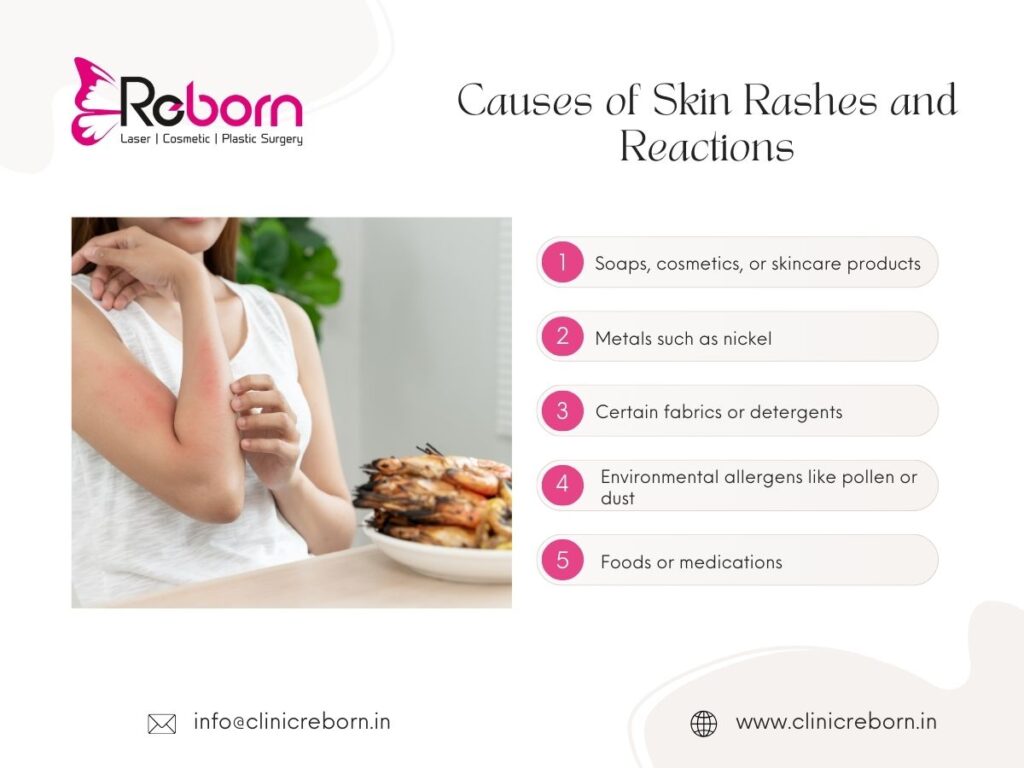 Causes of Skin Rashes and Reactions