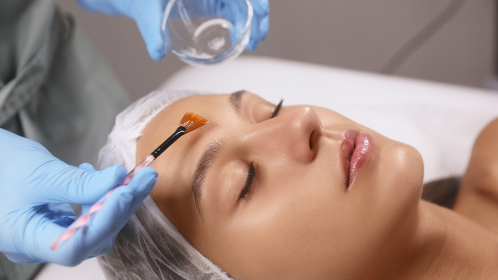 chemical peels at clinic reborn