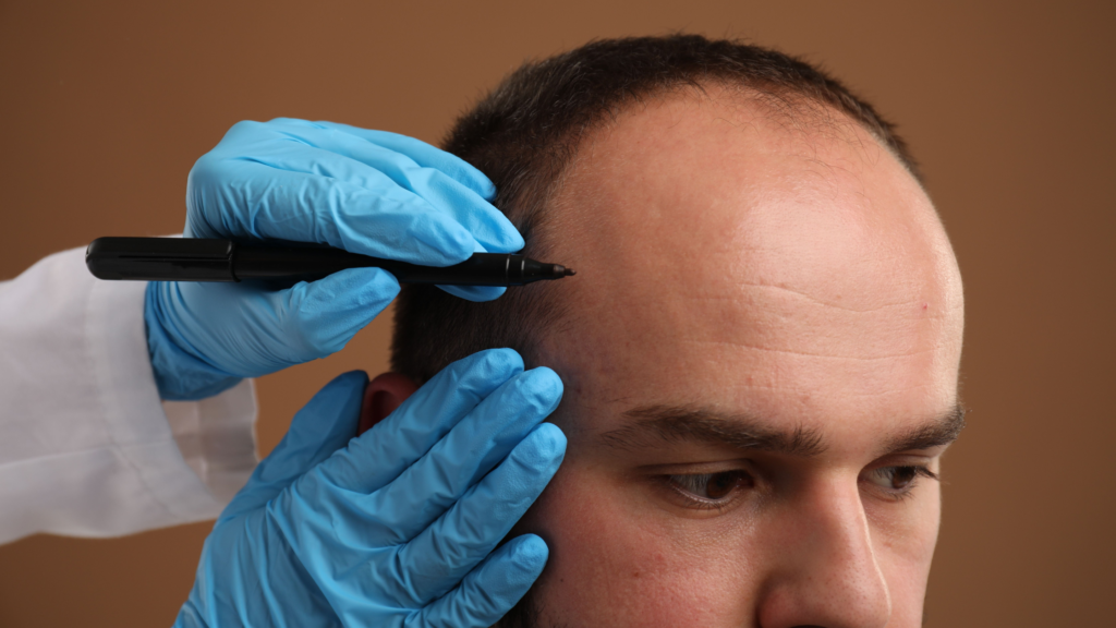 hair transplant at clinic reborn