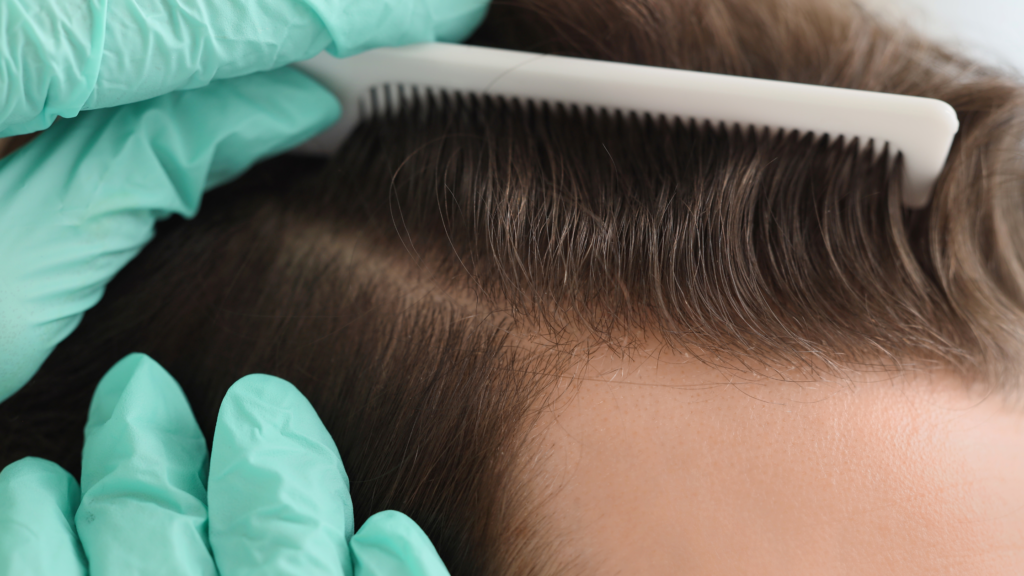hair transplant zirakpur