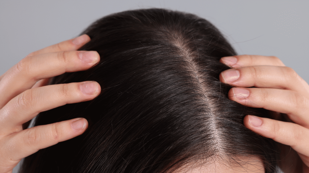dandruff free scalp
