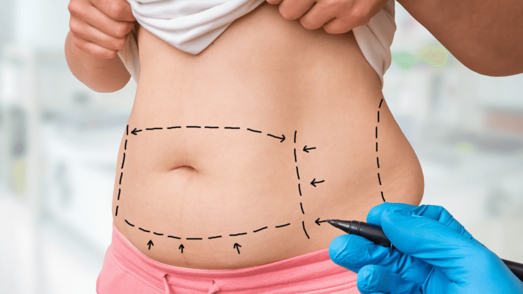 mommy makeover surgery clinic reborn