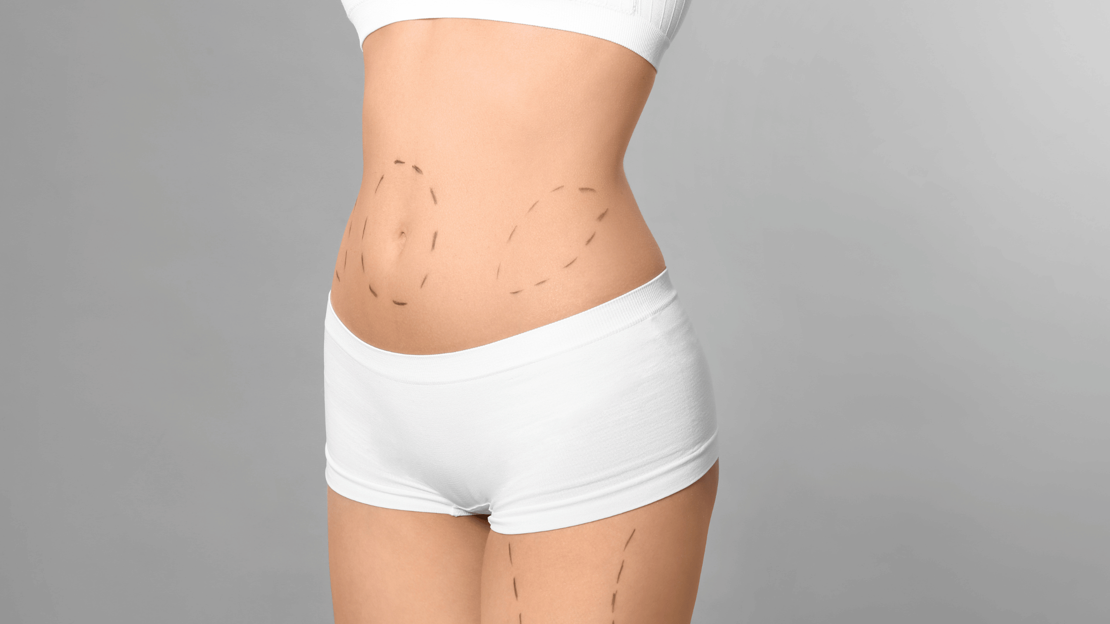 mommy makeover surgery