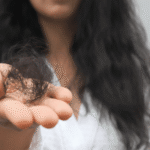 hair fall in monsoon
