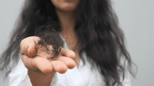 hair fall in monsoon