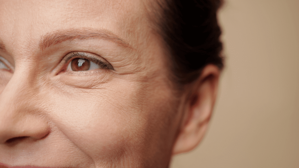 treatment for fine lines around eyes
