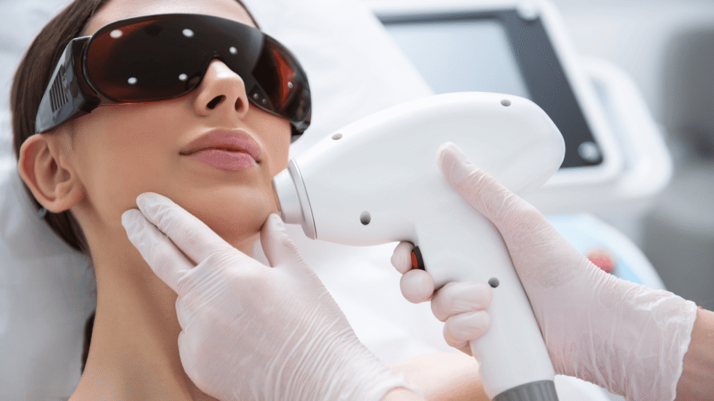 laser hair removal zirakpur