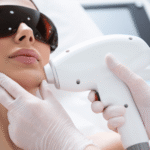 laser hair removal zirakpur