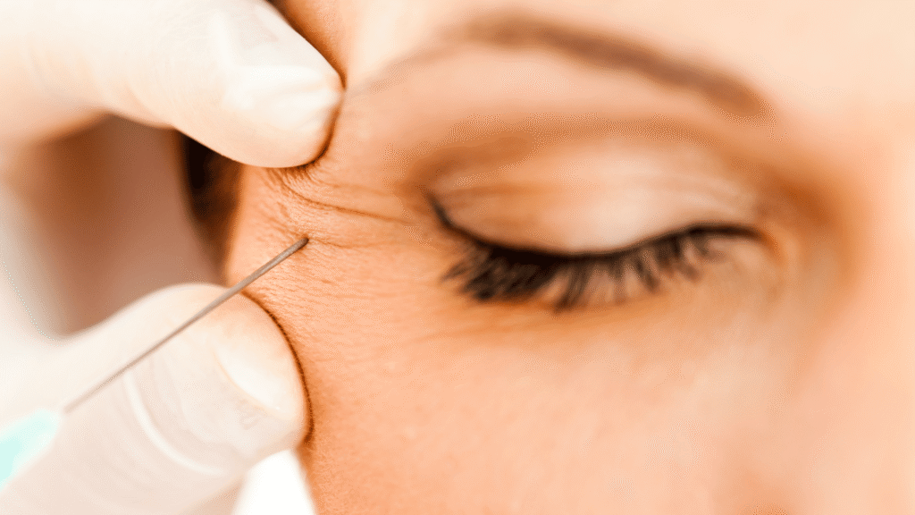 botox near eyes