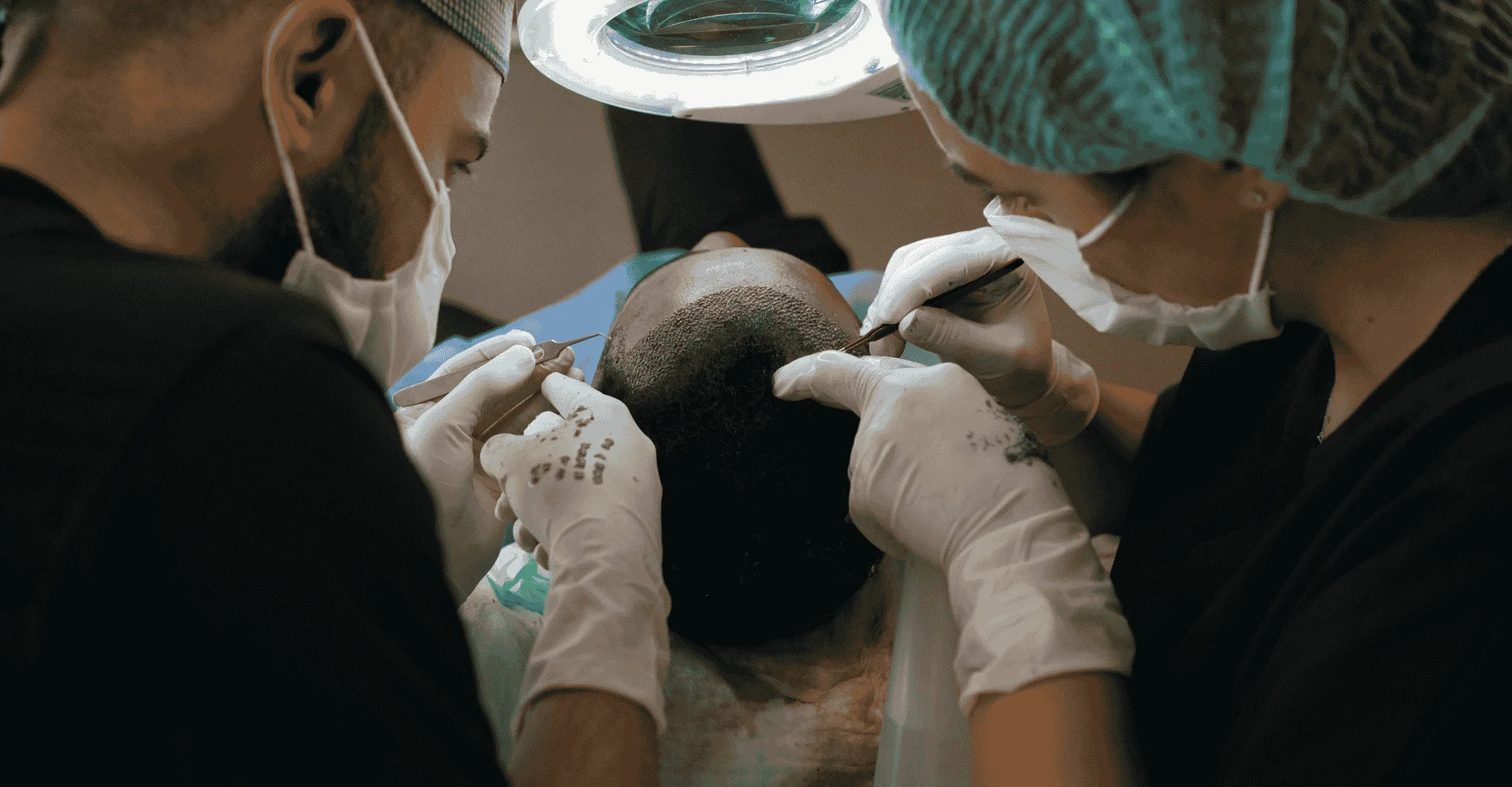 Hair transplant