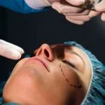 plastic surgery procedure on woman