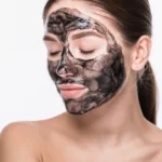 Chemical Peel Treatment in Zirakpur