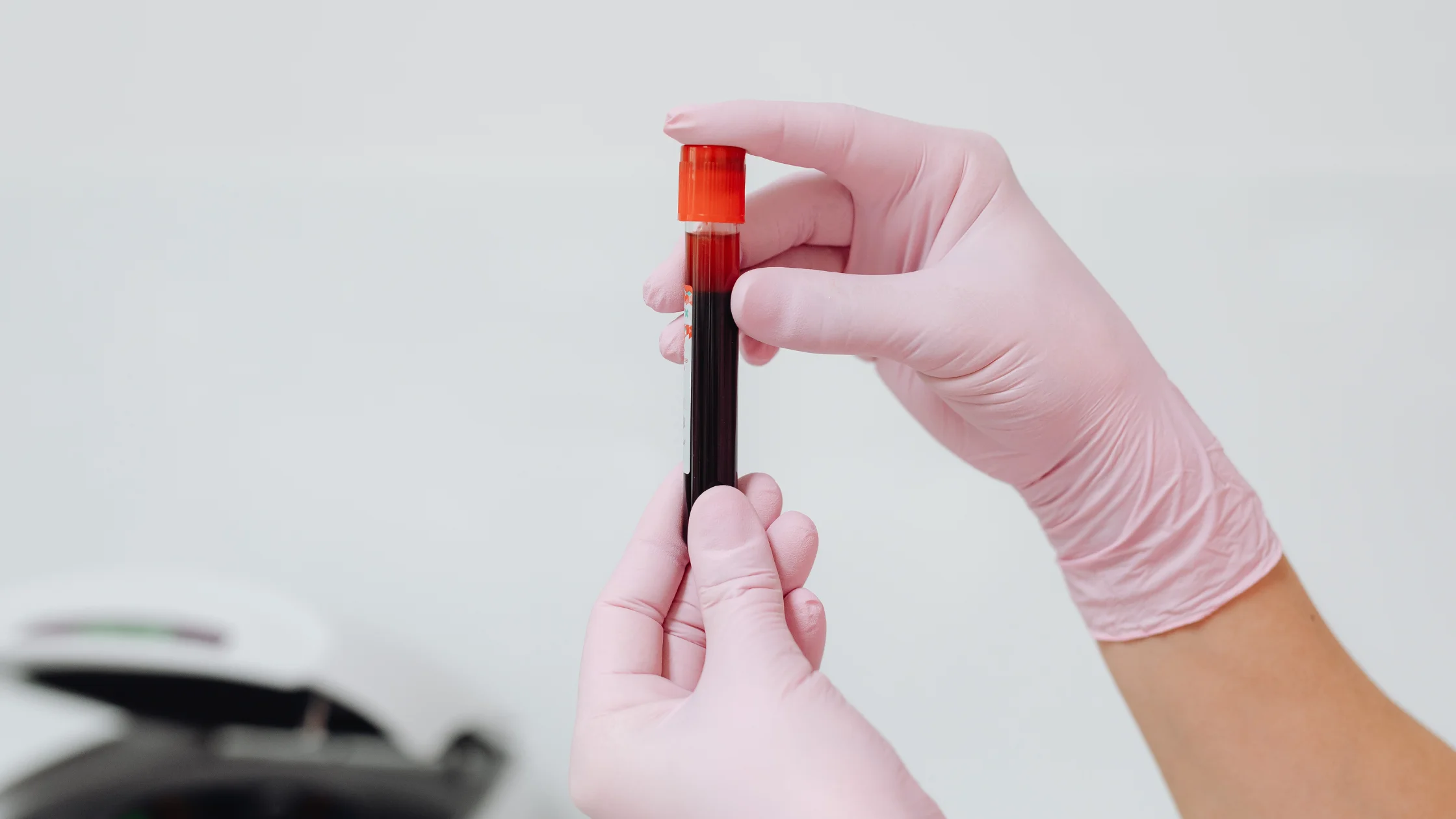 blood test for hairfall